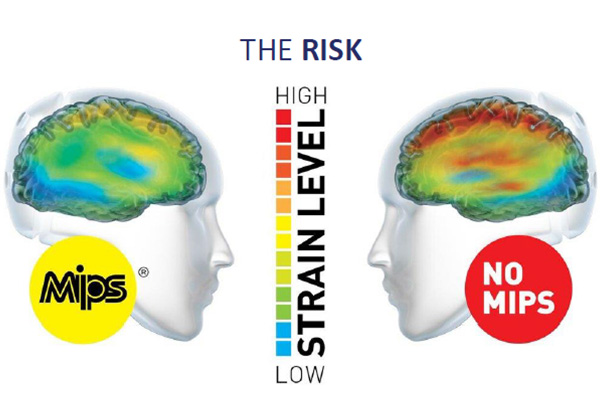 MIPS - risk level
